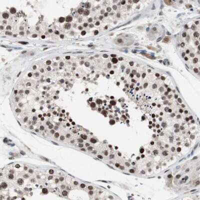 Immunohistochemistry-Paraffin: POGZ Antibody [NBP1-83005]
