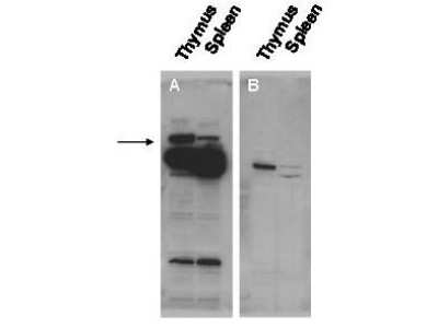 Western Blot: POGZ Antibody [NB110-85545]