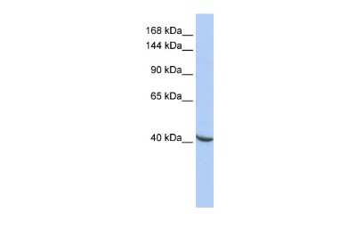Western Blot: POGZ Antibody [NBP3-10961]