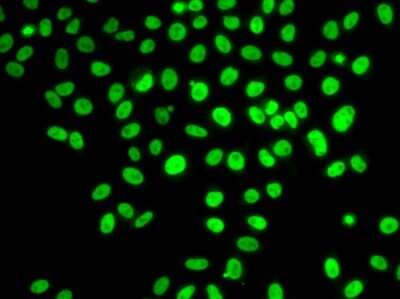 Immunocytochemistry/ Immunofluorescence: POLD3 Antibody - BSA Free [NBP2-93032]