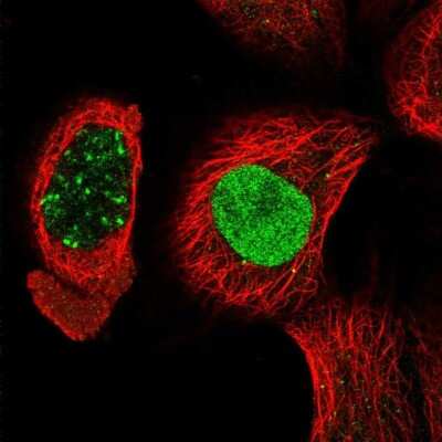 Immunocytochemistry/ Immunofluorescence: POLDIP1 Antibody [NBP2-14147]