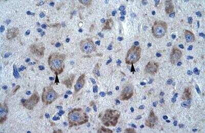 Immunohistochemistry-Paraffin: POLDIP1 Antibody [NBP1-80103]