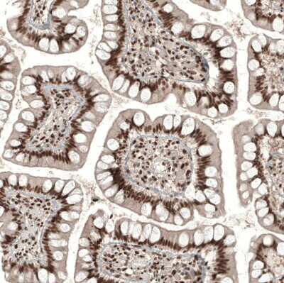 Immunohistochemistry-Paraffin: POLDIP1 Antibody [NBP2-14147]