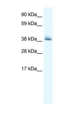 Western Blot: POLDIP1 Antibody [NBP1-80103]