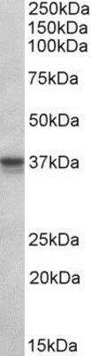 Western Blot: POLDIP2 Antibody [NBP1-68874]