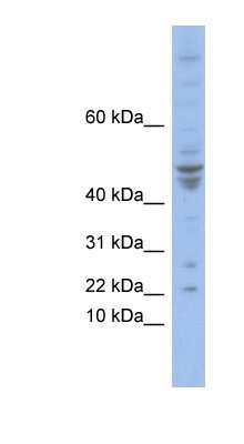 Western Blot: POLE4 Antibody [NBP1-80344]