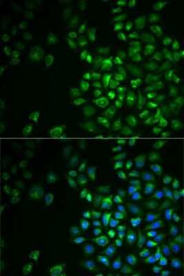 Immunocytochemistry/ Immunofluorescence: POLG2 Antibody - BSA Free [NBP2-94064]