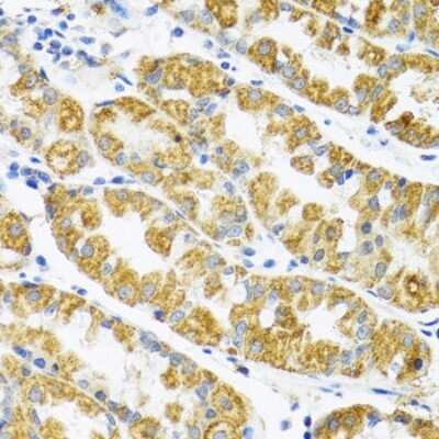 Immunohistochemistry-Paraffin: POLG2 Antibody - BSA Free [NBP2-94064]