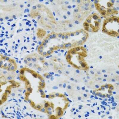 Immunohistochemistry-Paraffin: POLG2 Antibody - BSA Free [NBP2-94064]