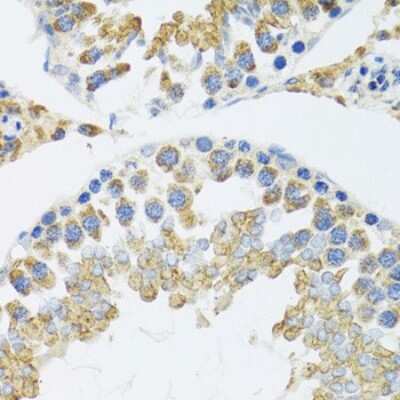 Immunohistochemistry-Paraffin: POLG2 Antibody - BSA Free [NBP2-94064]