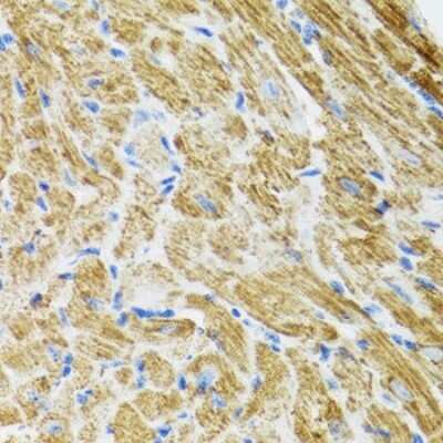 Immunohistochemistry-Paraffin: POLG2 Antibody - BSA Free [NBP2-94064]