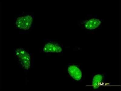Immunocytochemistry/ Immunofluorescence: POLR1B Antibody (4H6) [H00084172-M10]