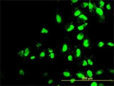 Immunocytochemistry/ Immunofluorescence: POLR1C Antibody (3A5-H2) [H00009533-M01]