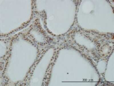 Immunohistochemistry-Paraffin: POLR1C Antibody (3A5-H2) [H00009533-M01]