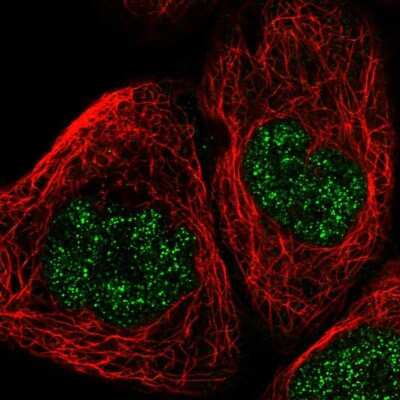 Immunocytochemistry/ Immunofluorescence: POLR1C Antibody [NBP1-87114]