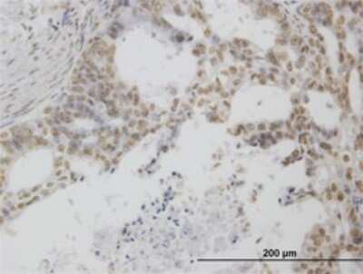 Immunohistochemistry-Paraffin: POLR1C Antibody (M1) [H00009533-M05]