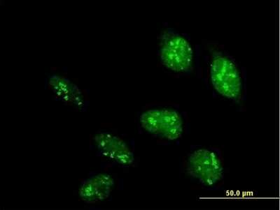 Immunocytochemistry/ Immunofluorescence: POLR1D Antibody [H00051082-B01P]