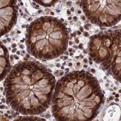 Immunohistochemistry-Paraffin: POLR2C Antibody [NBP1-80818]
