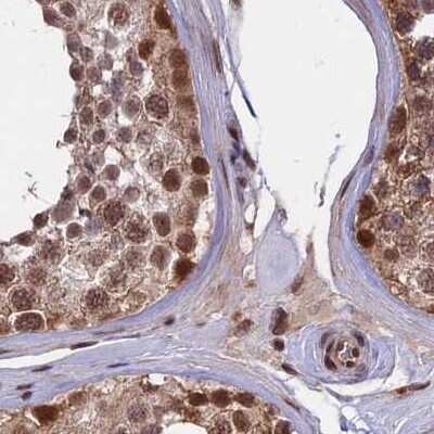 Immunohistochemistry-Paraffin: POLR2C Antibody [NBP1-80818]