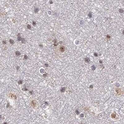 Immunohistochemistry-Paraffin: POLR2C Antibody [NBP1-80818]