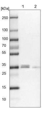 Western Blot: POLR2C Antibody [NBP1-80818]