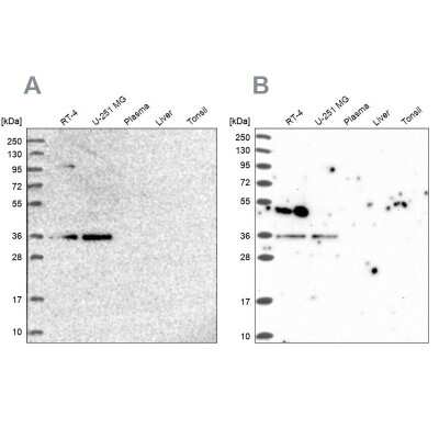 Western Blot: POLR2C Antibody [NBP1-80818]
