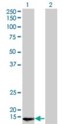 Western Blot: POLR2D Antibody (1E4-A5) [H00005433-M01]