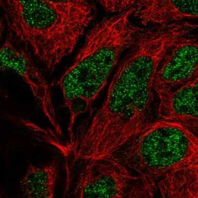 Immunocytochemistry/ Immunofluorescence: POLR2E Antibody [NBP2-57185]