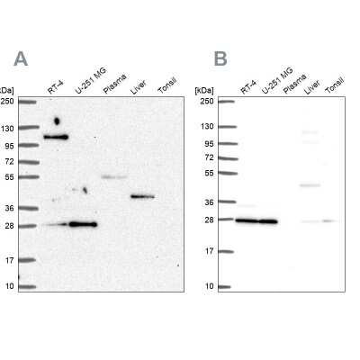 Western Blot: POLR2E Antibody [NBP2-57185]