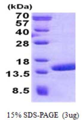 SDS-PAGE: Recombinant Human POLR2J2 His Protein [NBP2-23348]