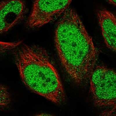 Immunocytochemistry/ Immunofluorescence: POLR3A Antibody [NBP1-83204]