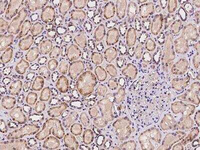 Immunohistochemistry-Paraffin: POLR3B Antibody [NBP3-06317]