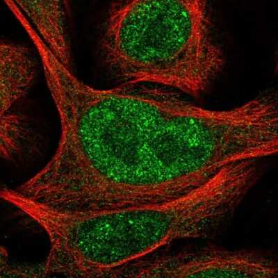 Immunocytochemistry/ Immunofluorescence: POLR3D Antibody [NBP2-56240]