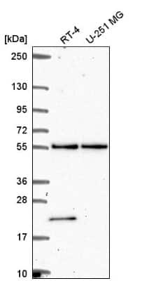 Western Blot: POLR3D Antibody [NBP2-56240]