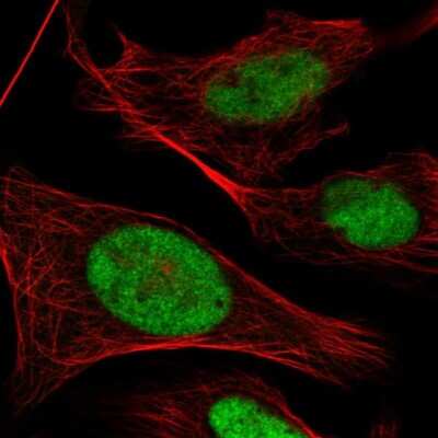 Immunocytochemistry/ Immunofluorescence: POLR3E Antibody [NBP2-58956]