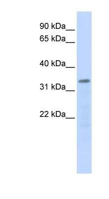 Western Blot: POLR3F Antibody [NBP1-52916]