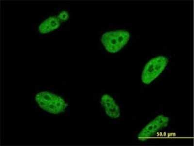 Immunocytochemistry/ Immunofluorescence: POLR3K Antibody (3F5) [H00051728-M01]