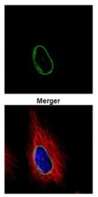 Immunocytochemistry/ Immunofluorescence: POM121 Antibody [NBP2-19890]
