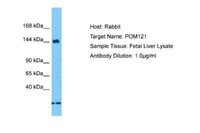 Western Blot: POM121 Antibody [NBP2-87975]