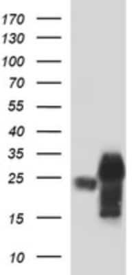 Western Blot: POMC Antibody (OTI2B2) [NBP2-45369]