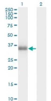 Western Blot: POMC Antibody (3E11) [H00005443-M01]