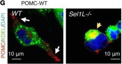 Immunohistochemistry: POMC Antibody [NB100-1533]