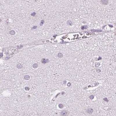 Immunohistochemistry-Paraffin: POMC Antibody [NBP2-55008]