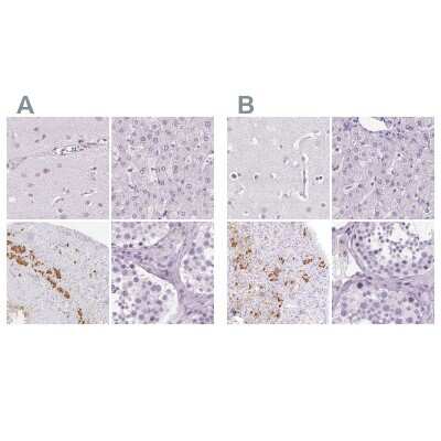 Immunohistochemistry-Paraffin: POMC Antibody [NBP2-55008]