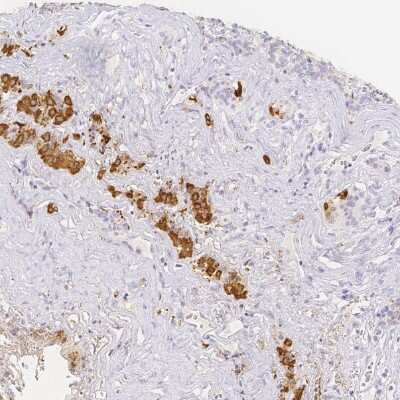 Immunohistochemistry-Paraffin: POMC Antibody [NBP2-55008]
