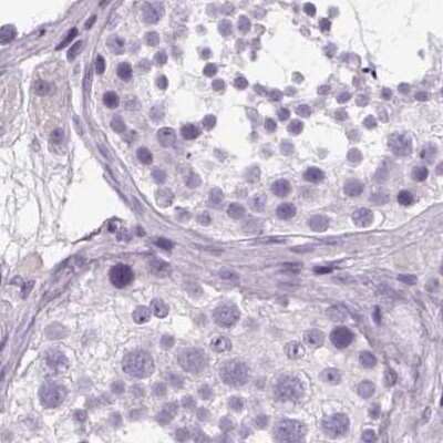Immunohistochemistry-Paraffin: POMC Antibody [NBP2-57719]