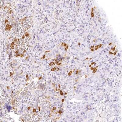 Immunohistochemistry-Paraffin: POMC Antibody [NBP2-57719]