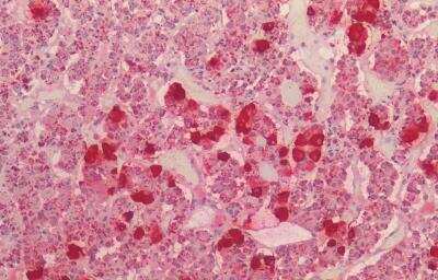 Immunohistochemistry-Paraffin: POMC Antibody [NBP3-12106]