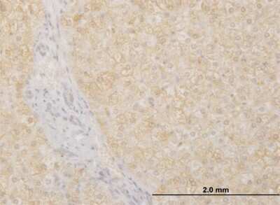 Immunohistochemistry-Paraffin: POMGNT1 Antibody (6C12) [H00055624-M07]
