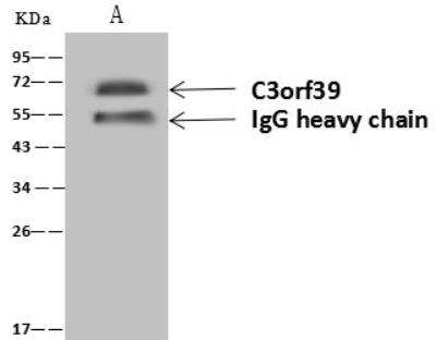 Immunoprecipitation: POMGNT2 Antibody [NBP3-12610]